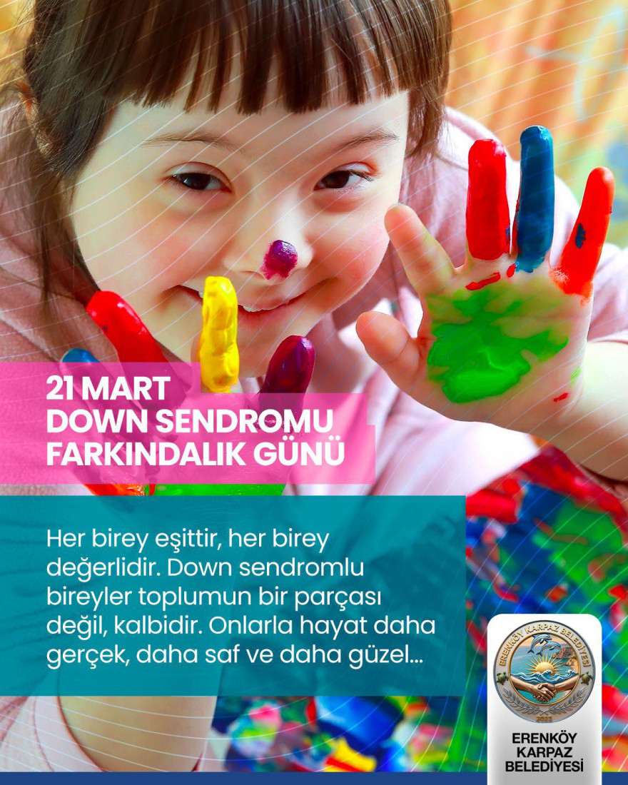 21 Mart Down Sendromu G&uuml;n&uuml;